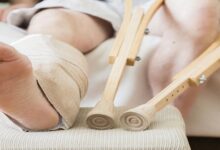 What Everyone Must Know About Tendon Repair